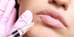 Μπότοξ στα Χείλη: Όλα Όσα Πρέπει να Ξέρετε-Dr Koutsoukou Elina