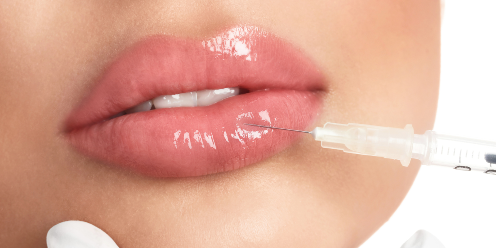 Fillers Υαλουρονικού: Τι Είναι & Πού Εφαρμόζονται-Dr Koutsoukou Elina