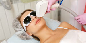 Laser στο Πρόσωπο: Πόσο Ασφαλές Είναι και Τι να Περιμένεις-Dr Koutsoukou Elina