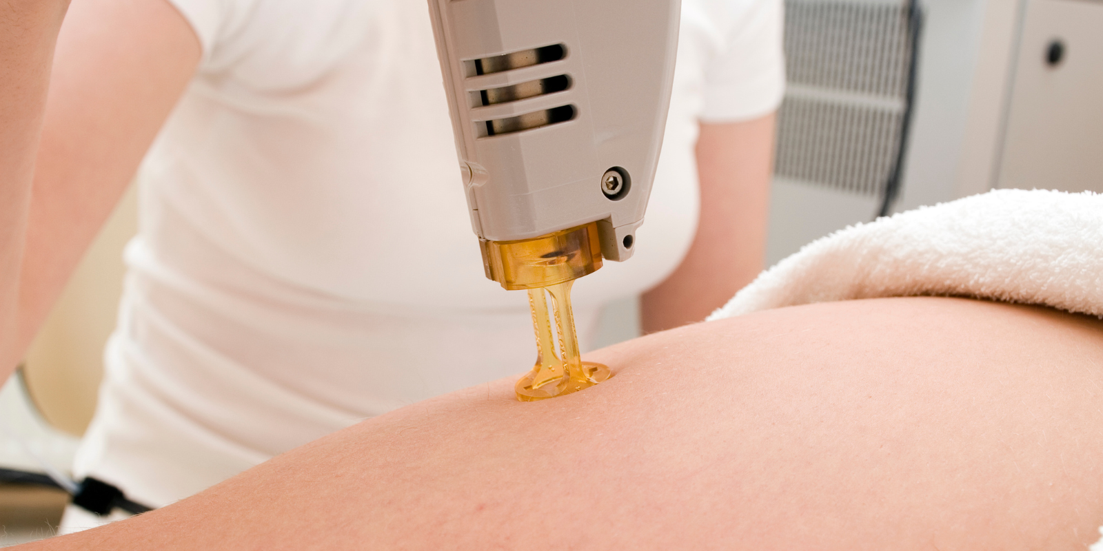 Σύγκριση μαυρισμένου δέρματος και φυσικού τόνου για laser αποτρίχωση — γιατί ο χειμώνας είναι η ιδανική εποχή