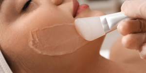Τι Είναι το Peeling Προσώπου & Ποια Είναι τα Οφέλη του;-Dr Koutsoukou Elina