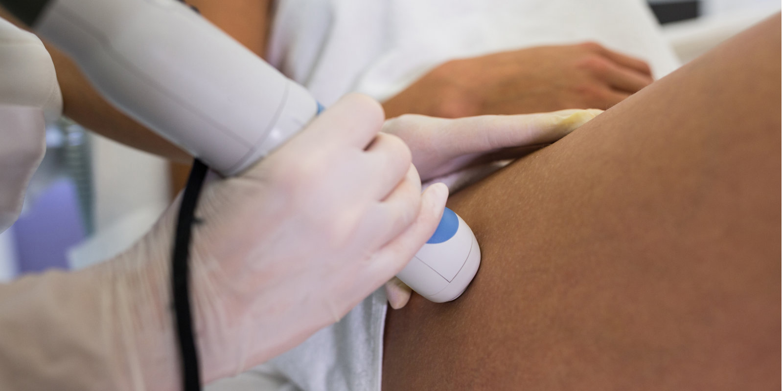 Γυναίκα που υποβάλλεται σε laser αποτρίχωση μηρού στο δερματολογικό ιατρείο Dr. Κουτσούκου Νέο Ψυχικό